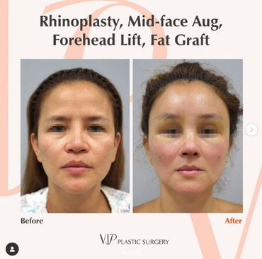 Slider image (4) VIP Plastic Surgery